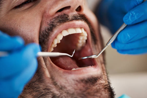 Best Sedation Dentistry  in Gruver, TX